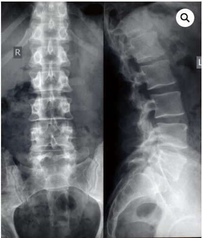 Radiología Uno - El sitio para las imágenes médicas 1 Radiografía de Columna en radiologia.uno