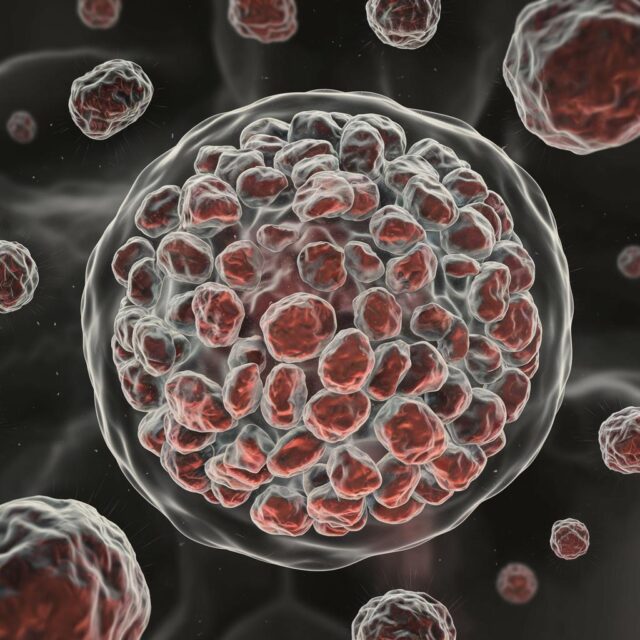 La Hematología Completa 4 Eosinofilos - Hemograma